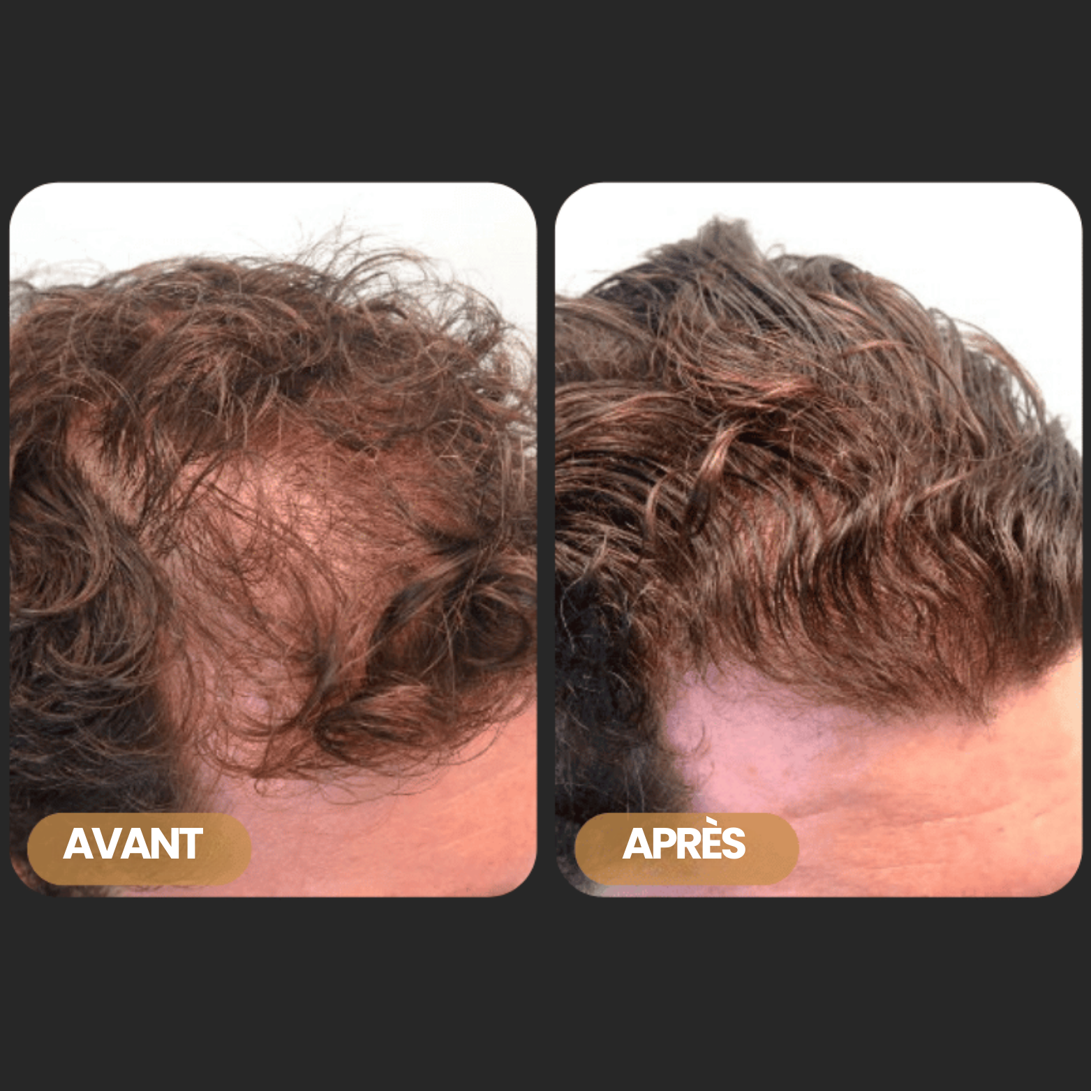 Shampoing Activateur de Racines