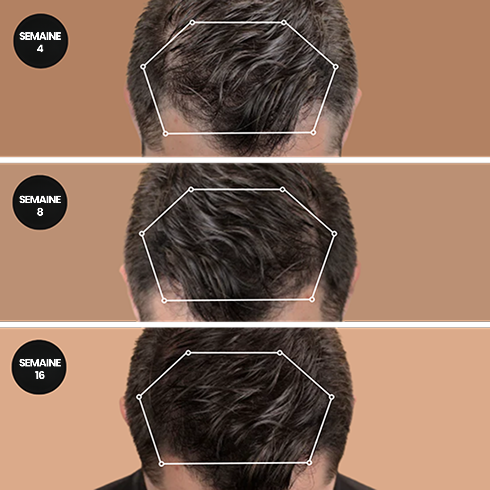 Shampoing Activateur de Racines