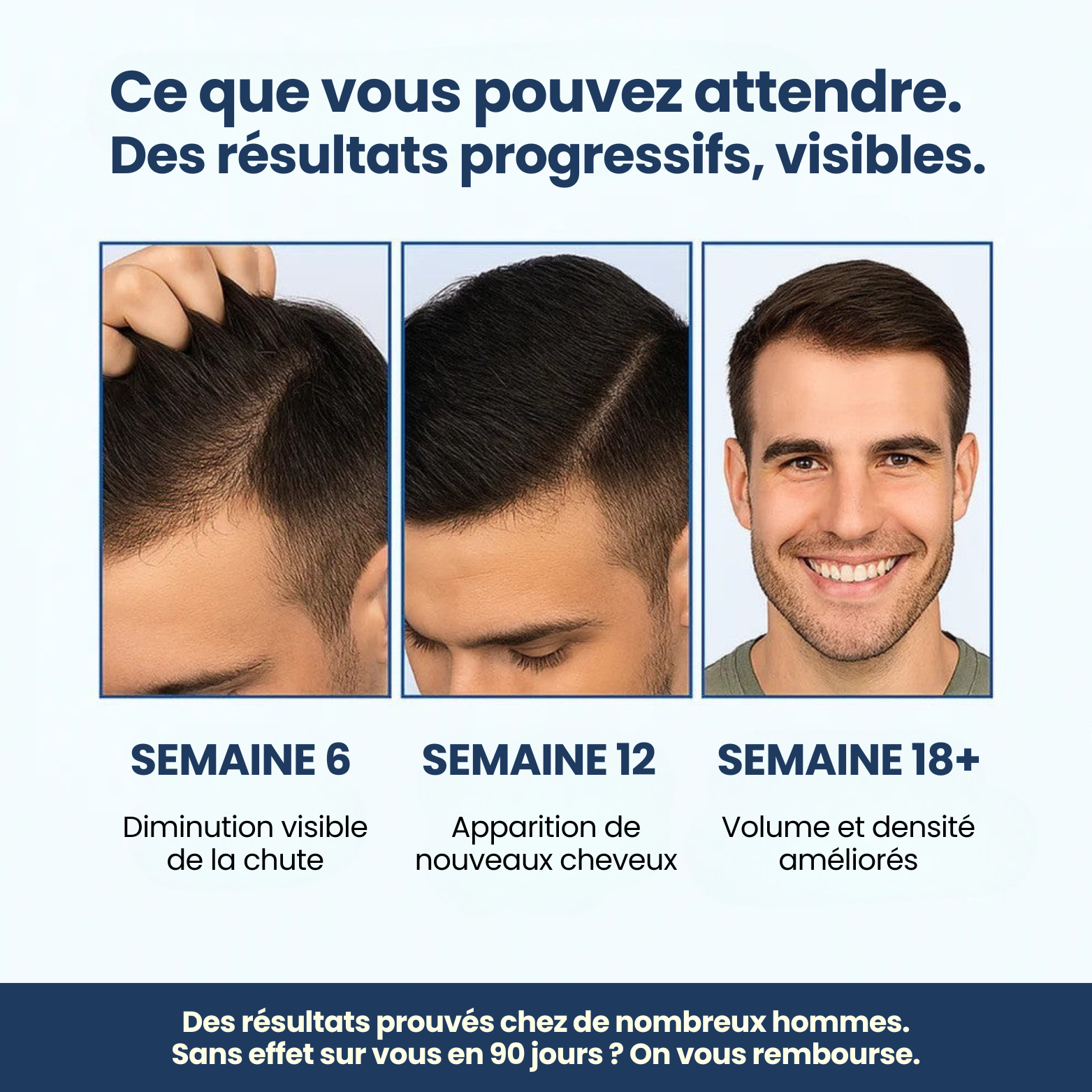 Sérum Roller Croissance+