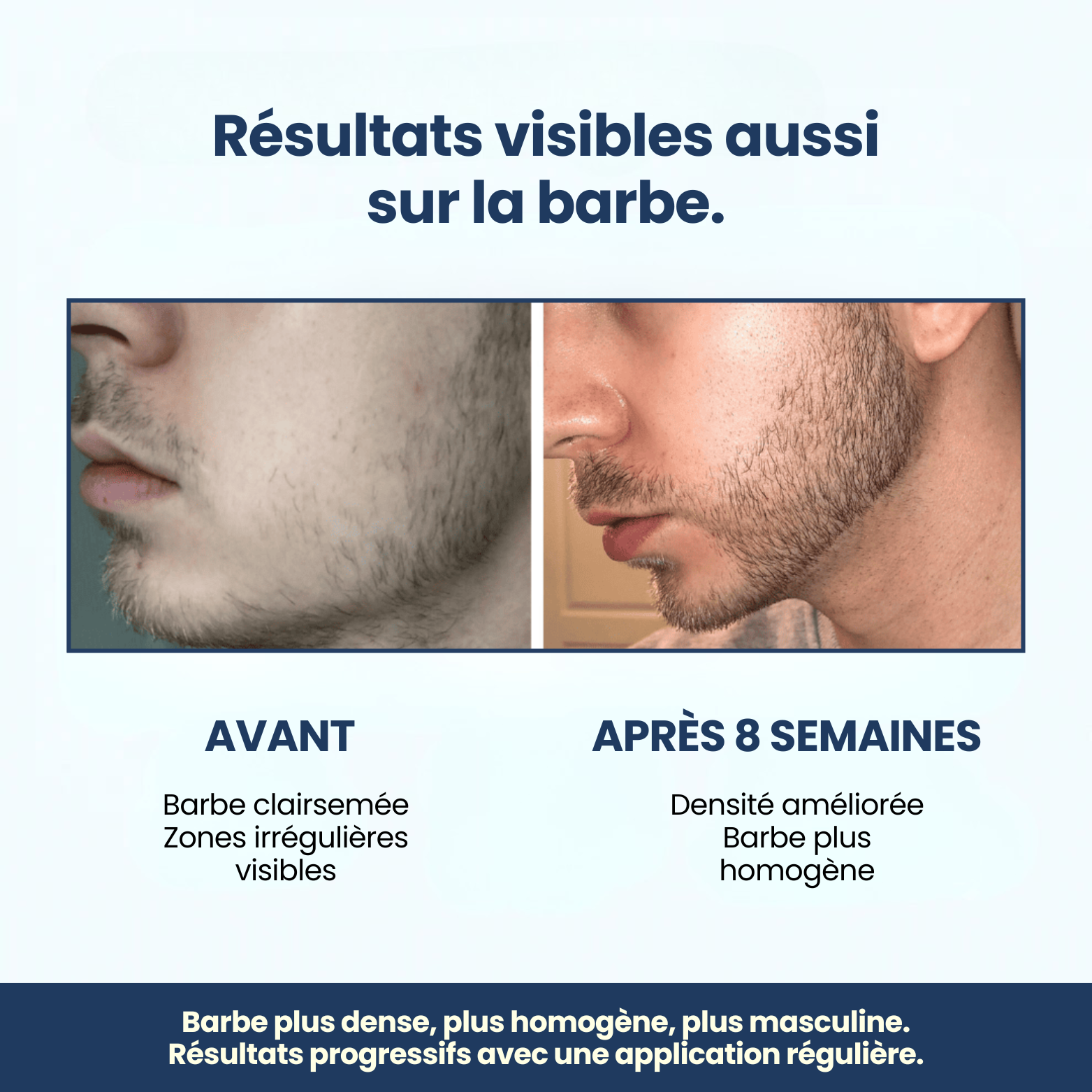 Sérum Roller Croissance+