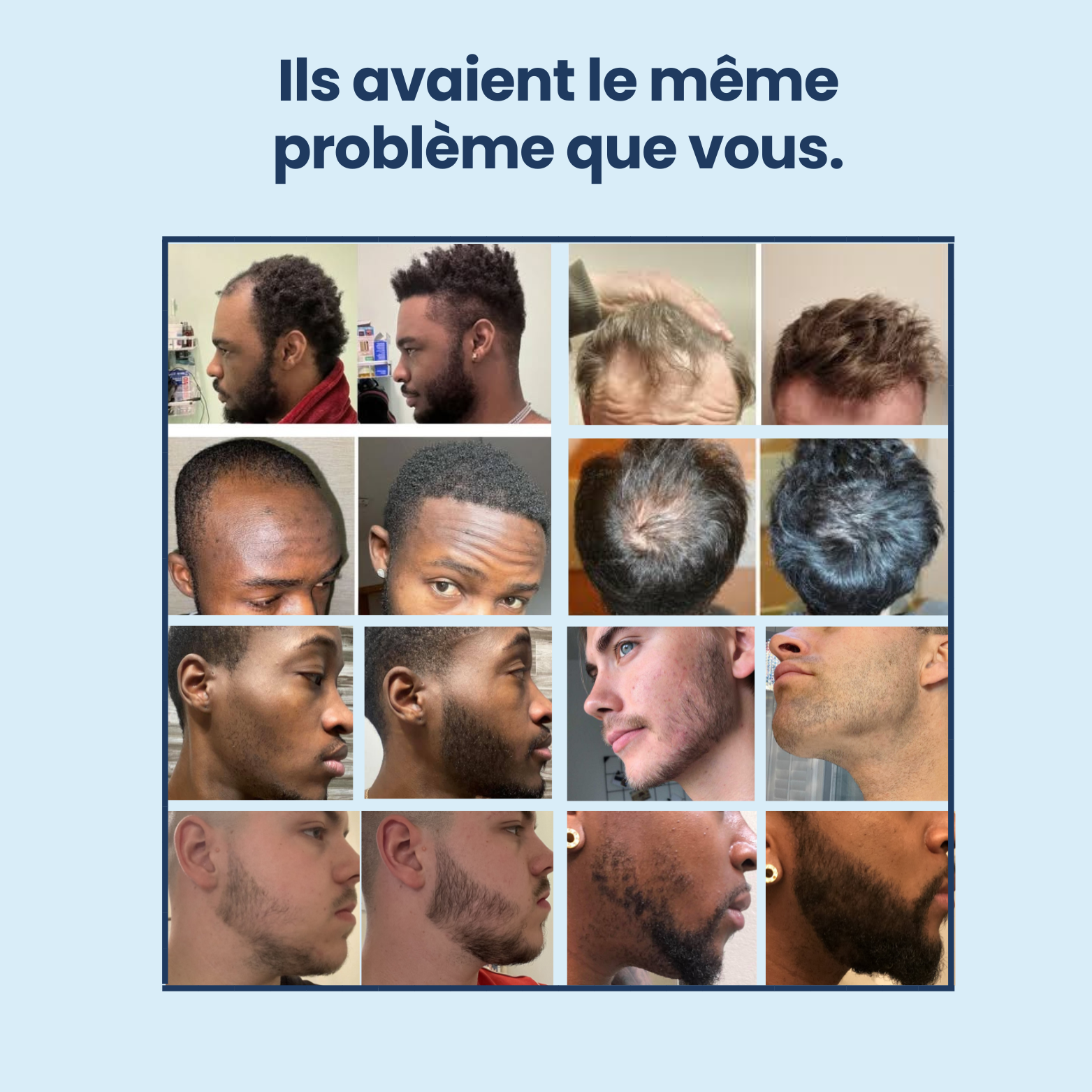 Sérum Roller Croissance+