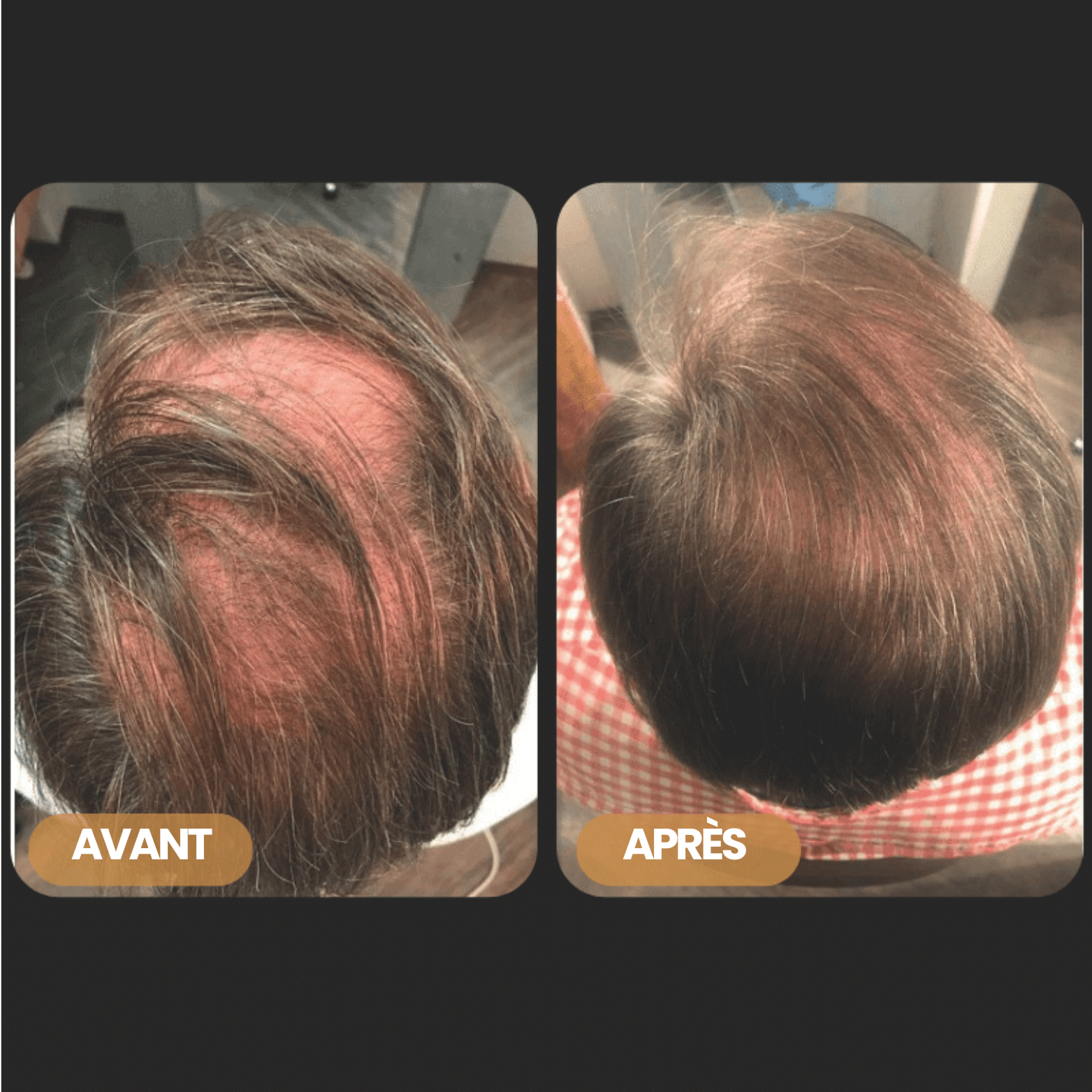 Shampoing Activateur de Racines